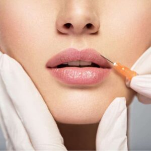 לא חייבים בוטוקס – הכירו את השיטה הטבעית: עיבוי ועיצוב שפתיים בעזרת חומצה היאלורונית